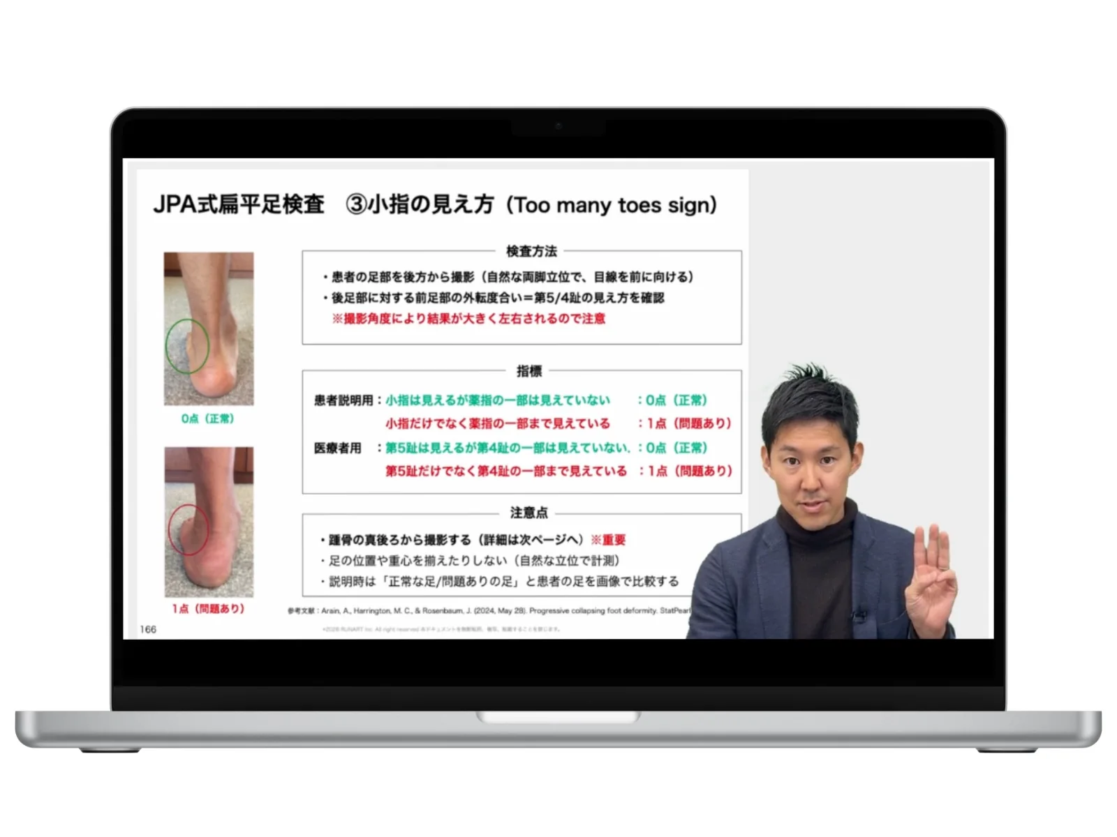 実際のオンライン講義:足部評価の解説画面