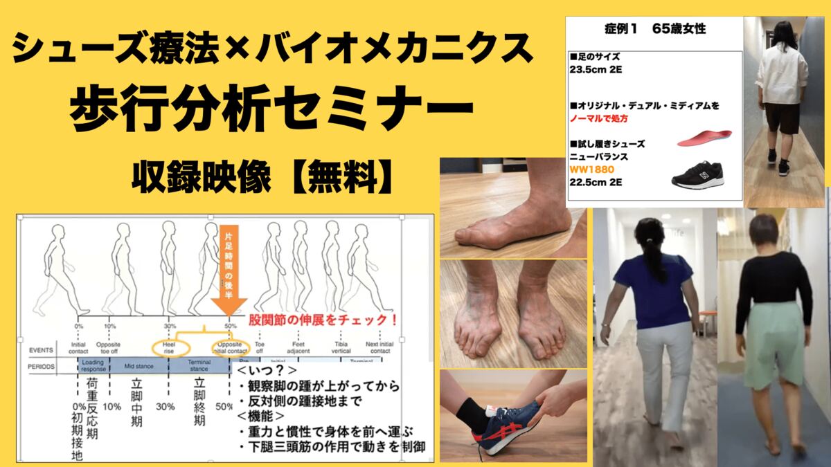 シューズ療法×バイオメカニクス 歩行分析セミナーの収録映像（症例スライド・歩行動画・シューズ処方例）
